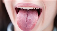 سرطان زبان، علائم، تشخیص و درمان آن (بخش اول)