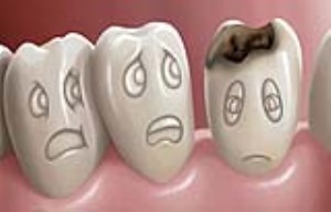 چه عواملی موجب فساد دندان ها می شود؟