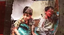 مقایسه ی آمار مبتلایان کرونا در جهان و آمار کشتگان یمن
