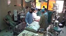 ابداع تکنیک جراحی قلب جهان در ایران