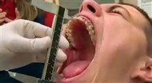 ثبت رکورد دهان گشادترین آدم دنیا