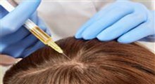 درمان ریزش مو با مزوتراپی و پی‌آرپی؛ سراب یا واقعیت؟