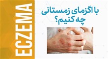 موشن گرافیک | با اگزمای زمستانی چه کنیم؟ (اینستاگرامی)