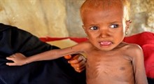 گریه مرد یمنی که نمی‌تواند کودکش را سیر کند