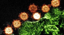 آیا ویروس کرونا جنگ بیولوژیک است؟!