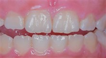 جنس دندان از نظر طب سنتی/ دکتر مژده پورحسینی