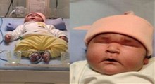 تصاویری از سنگین‌ترین نوزادِ ایرانی