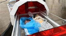 شهادت دو نوزاد دیگر در غزه بر اثر سوء تغذیه