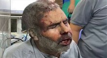 مرد مجروح فلسطینی: همه ما با "مقاومت" هستیم