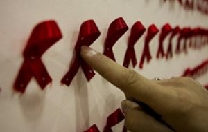 درمان ایدز با پیوند «سلول‌های بنیادی»