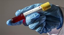 آخرین آمار از ویروس کرونا در کشور/ مجموع مبتلایان به 2922 رسید