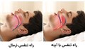 همه چیز درباره آپنه خواب یا وقفه تنفسی و خطرات آن