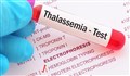 علائم، علل، تشخیص و درمان تلاسمی