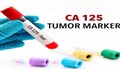 هرآنچه که باید راجع به آزمایش CA-125 آنتی ژن سرطانی بدانیم
