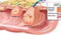 تحليلي بر سرطان روده بزرگ با رويكرد سبب شناختي-درماني