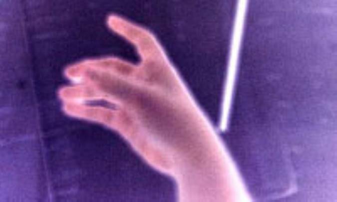 بیماری‌های نوازندگان