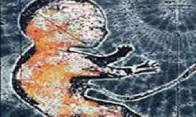 بیماری 40 درصد مردان نابارور