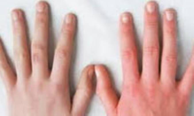 خانم های ورزشکار را از روی انگشتانشان بشناسید