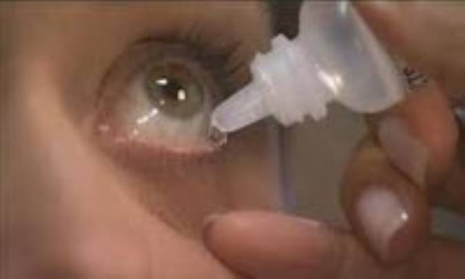 اشک مصنوعی (ARTIFICIAL TEARS)