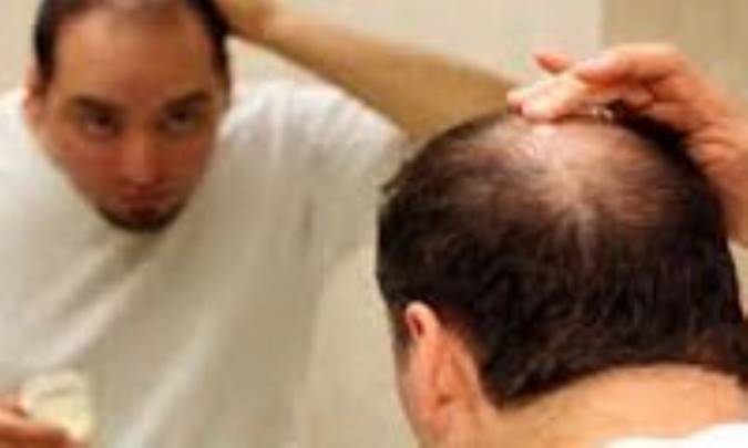 ماساژ پوست سر