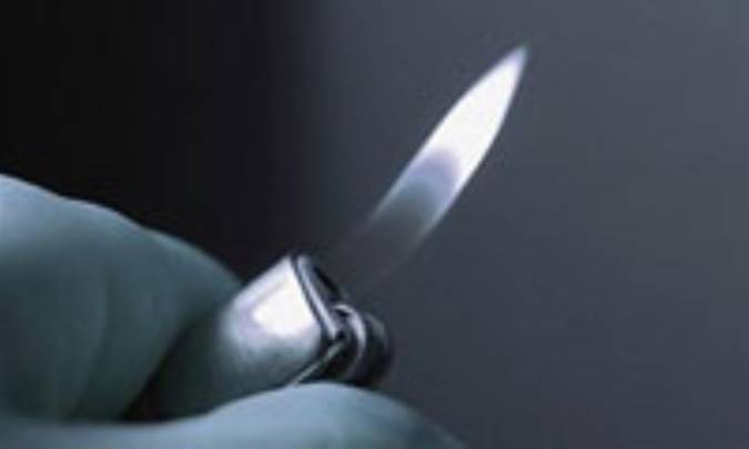 واکنش احتراقی چیست؟