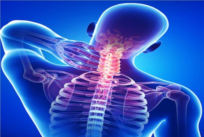 درمان گردن درد و علت آن