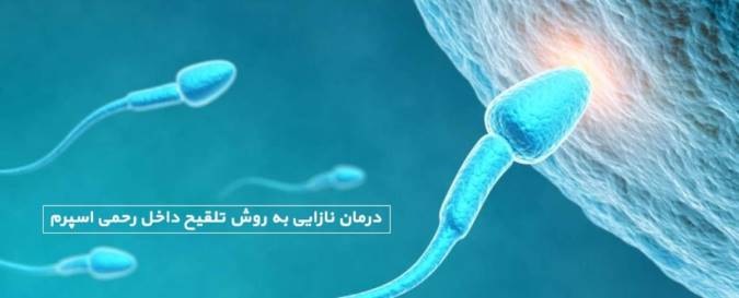 مشکل نازایی
