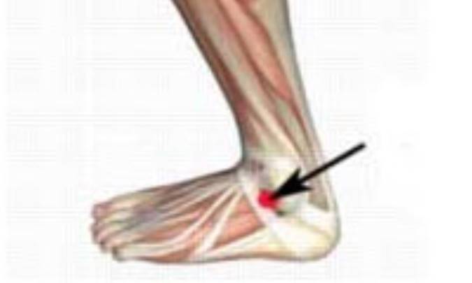 علت درد جلوی ساق پا چیست؟