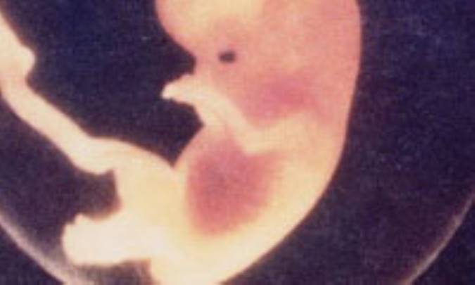 بارداري بعد از روش‌هاي ضدبارداري