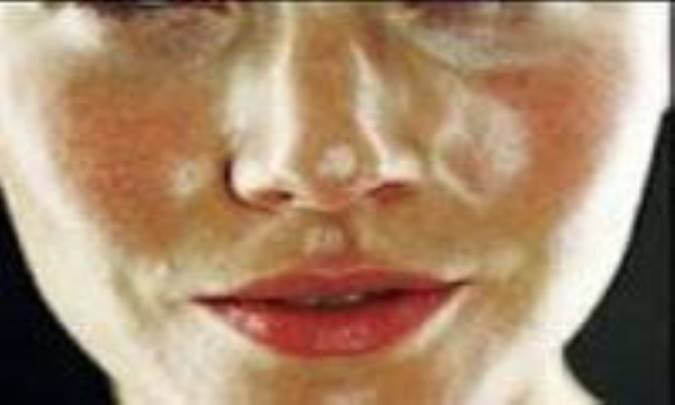 نکته‌هایی برای محافظت از پوست