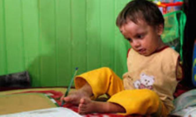 کودکان دارای معلولیت جسمی - حرکتی