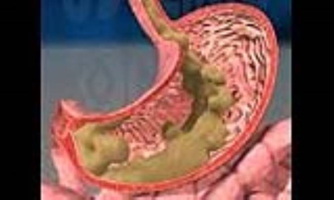 هضم مکانیکی در مقابل هضم شیمیایی