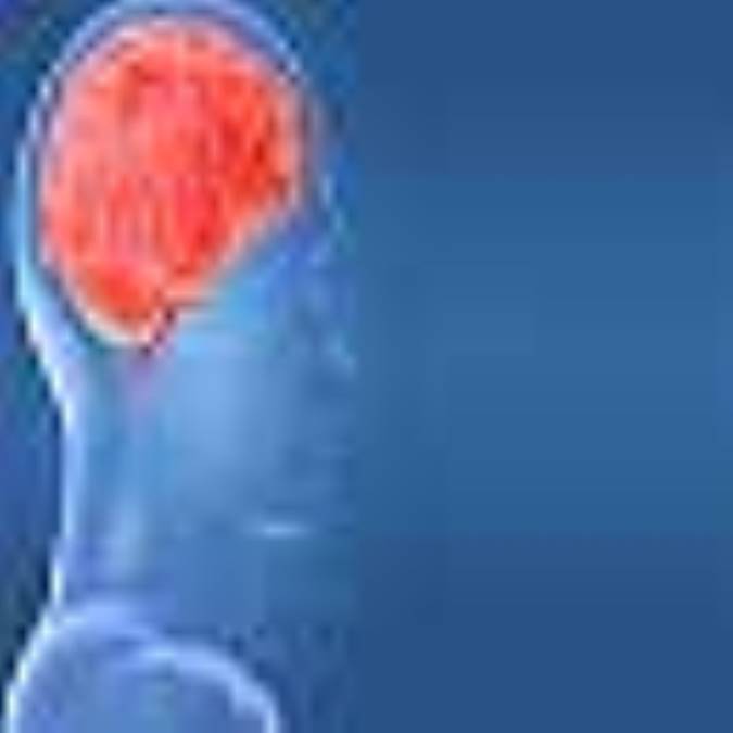 نتايج MRI مغز عاشقان