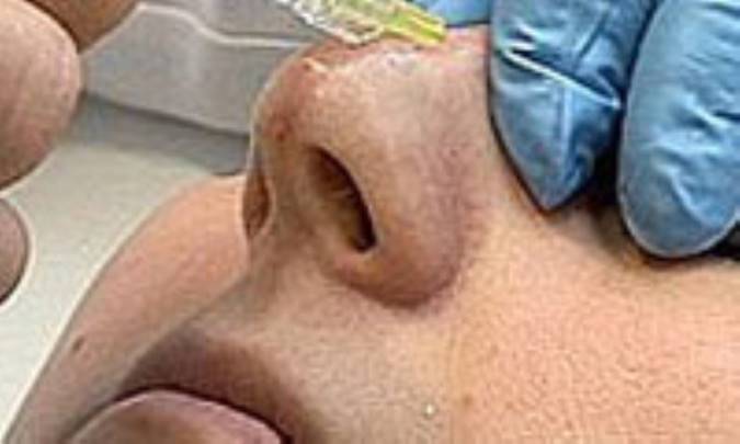 تلفيق جراحي زيبائي با جراحي سرطان