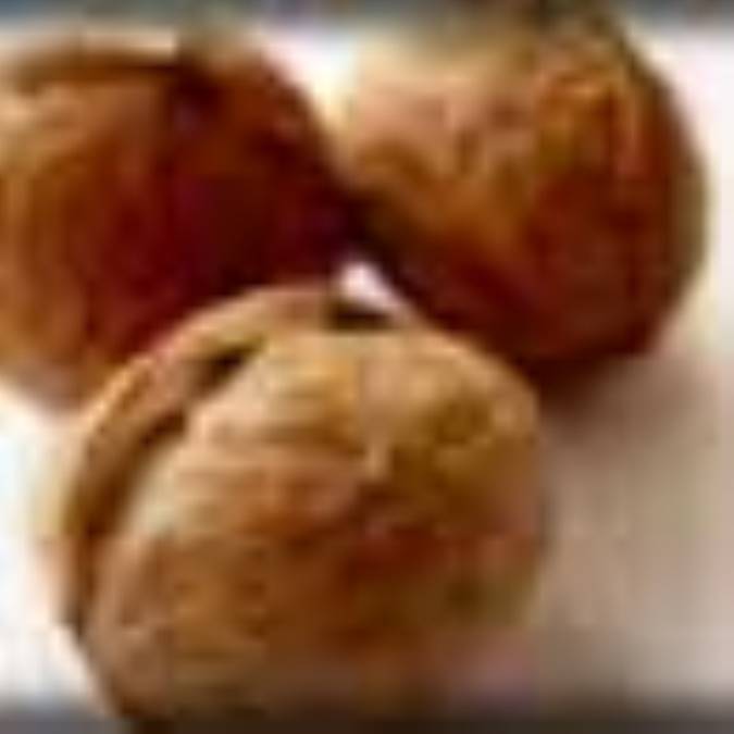 گردو از تشکيل سنگ کليه جلوگيري مي کند