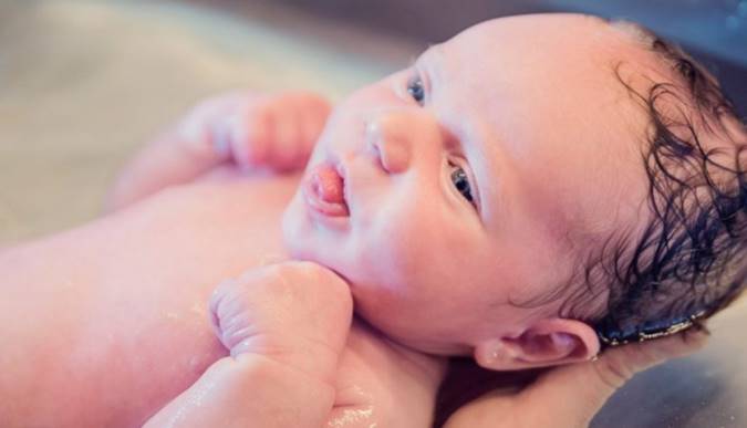 زایمان در آب