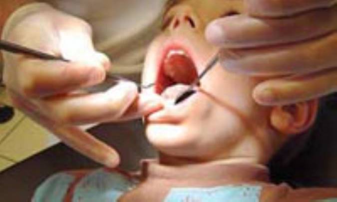 کشيدن دندان تا روز مبادا ممنوع!