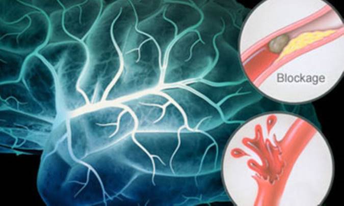 توقف در ایستگاه مغز