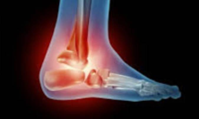 علایم درد پای دیابتی