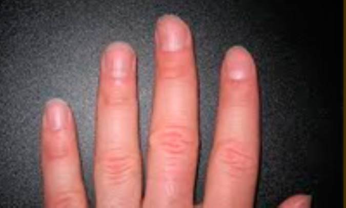 ویتامین‌ها برای سلامت ناخن‌ها