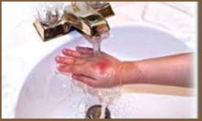 درمان‌های خانگی سوختگی با بخار