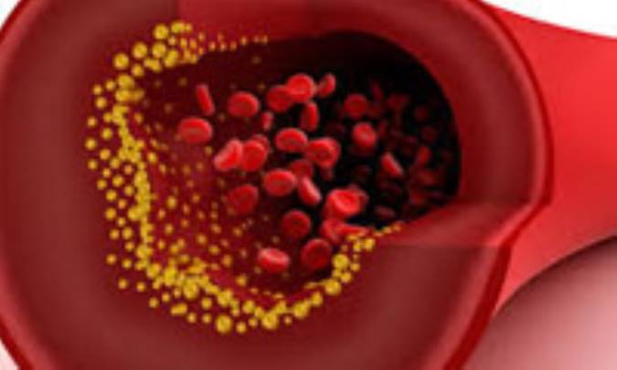 سطوح ایده‌آل کلسترول