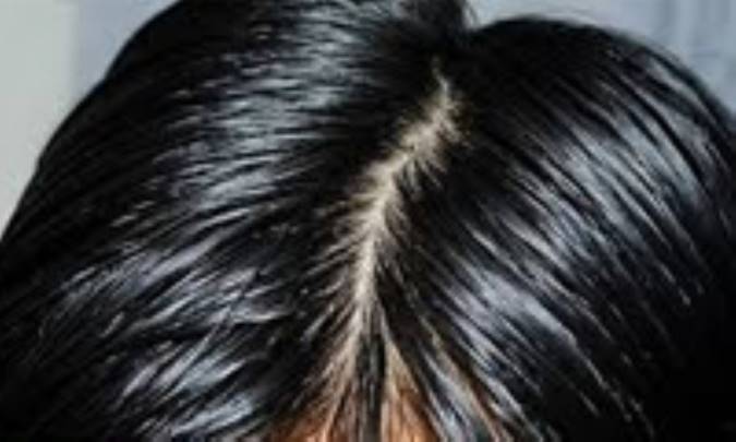 مراقبت از موی چرب