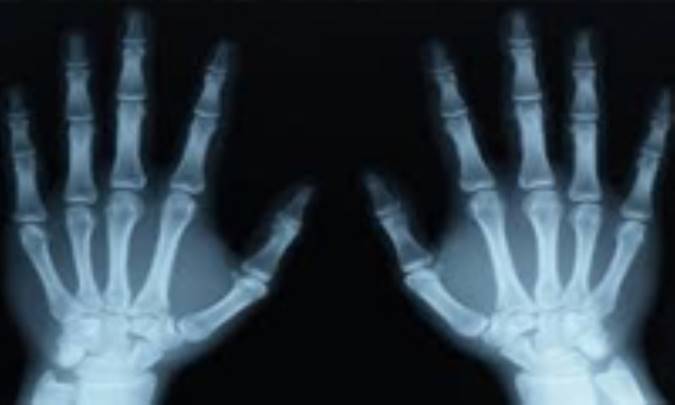 امواج كوتاه و موفقیت در آنها