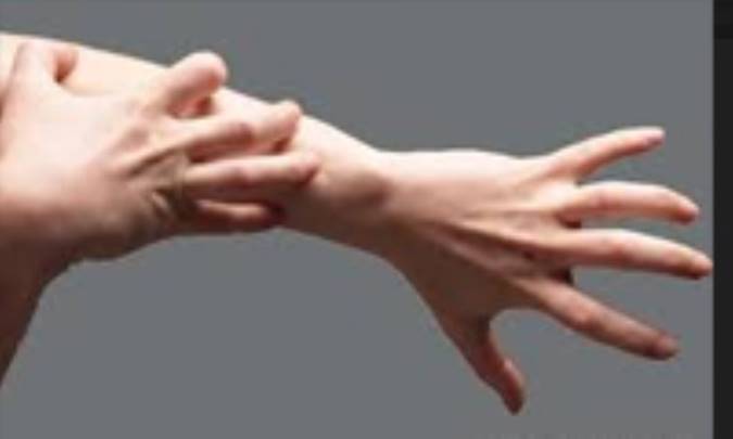 علل خارش شدید