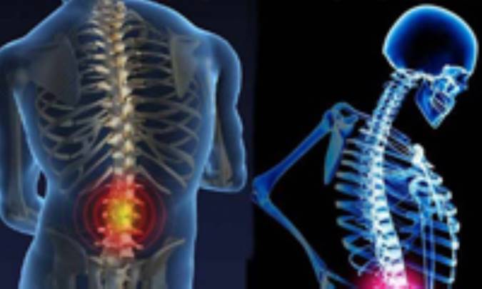 بیماری‌های دستگاه اسکلتی