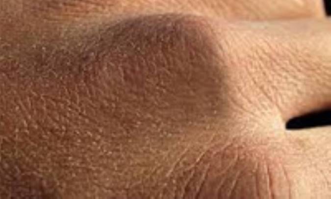 مواد غذایی مفید برای پوست