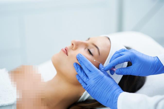 لیفت شقیقه با نخ بدون درد چگونه است؟
