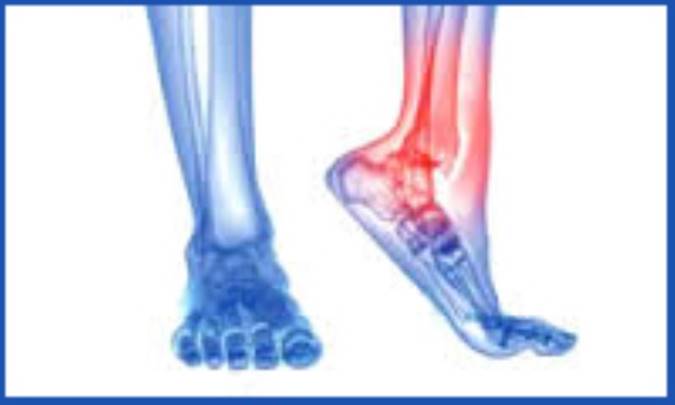 نگاهی به علائم و نشانه های اصلی درد پا در افراد دیابتی