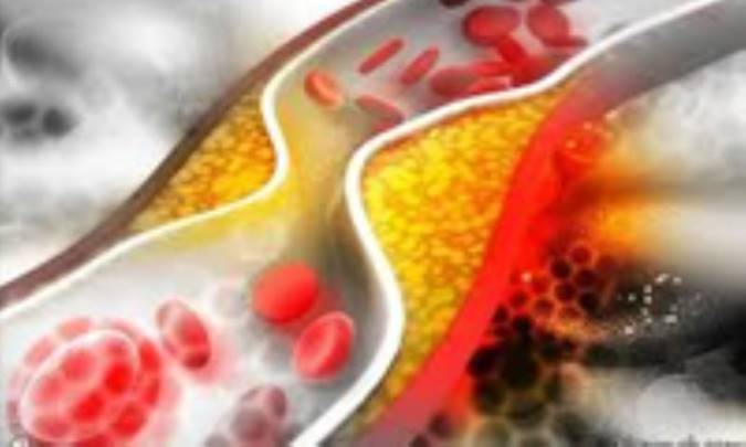 نمودار سطوح کلسترول